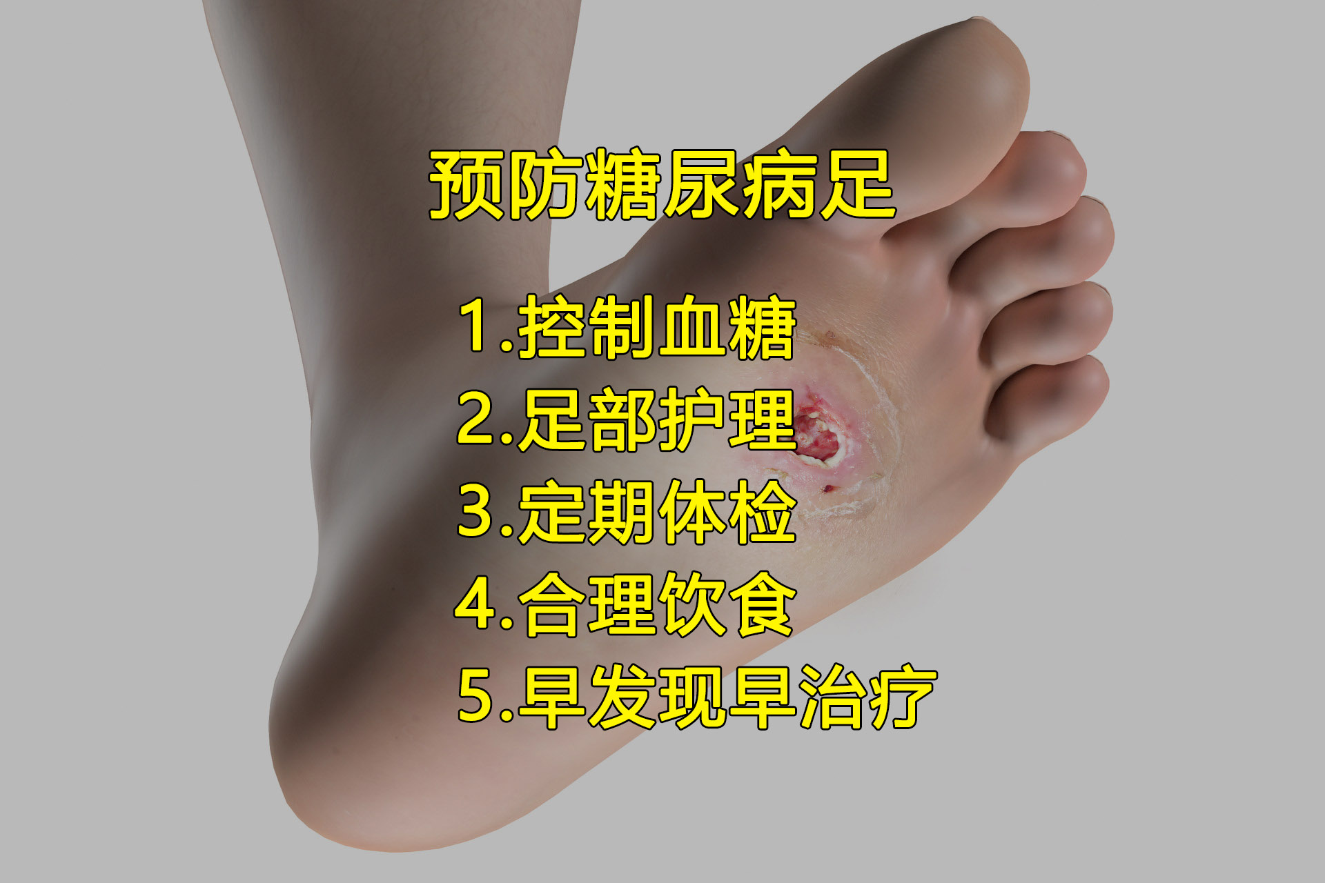 好安森糖尿病治疗仪：如何预防糖尿病足？