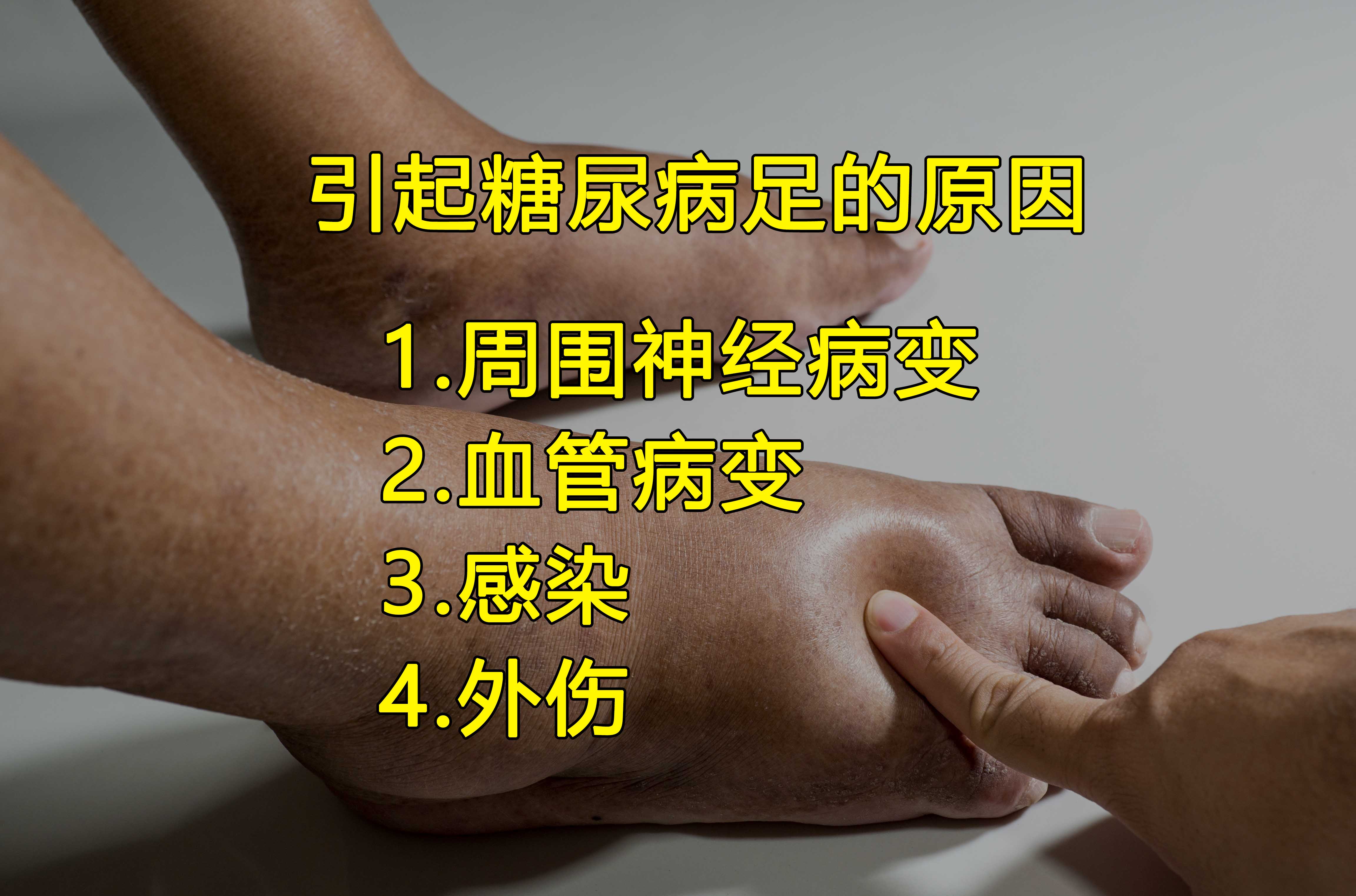 好安森糖尿病治疗仪：糖尿病足是怎么形成的？