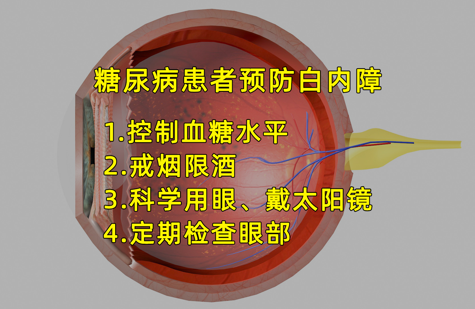 好安森糖尿病治疗仪：糖尿病患者如何预防白内障？