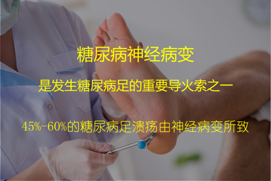 好安森糖尿病治疗仪：糖友脚部有这5种症状 千万不能拖 或许是糖尿病足