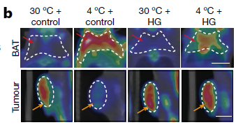 癌症治疗新方法！Nature最新研究：低温可抑制多种肿瘤生长