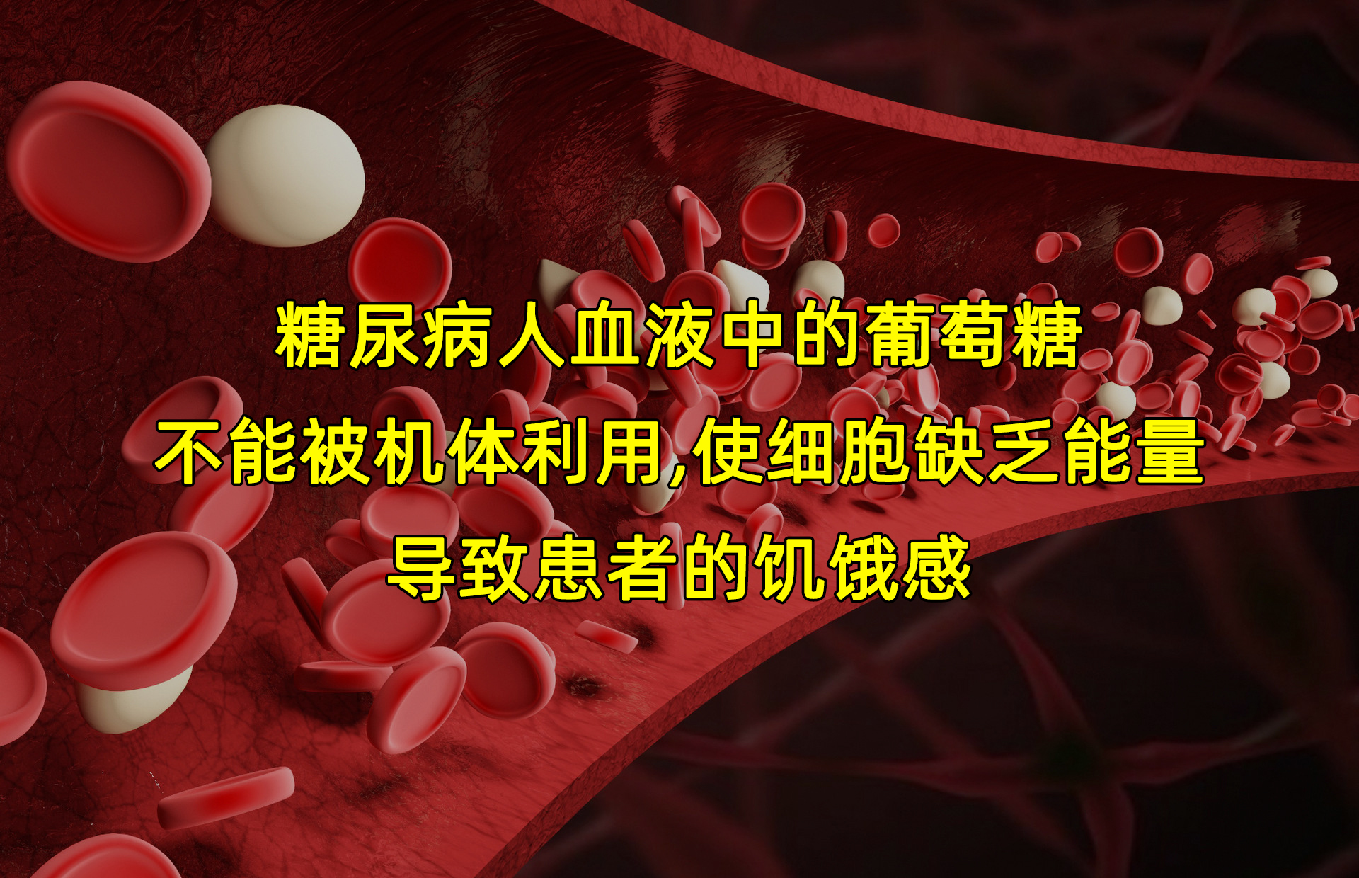 糖尿病人总是感觉饿该怎么办？吃饭时遵循这4点！